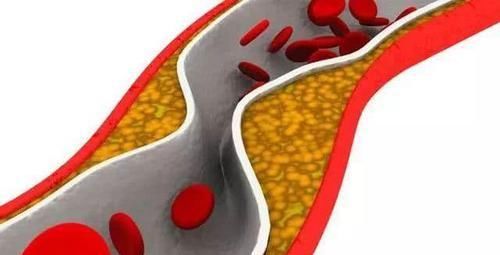 血脂高低决定寿命长短，常吃这几种天然食物，血脂平稳更长寿