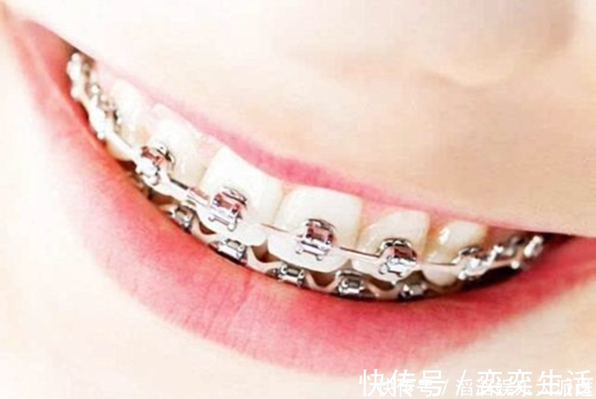 孩子|好不容易等到宝宝换牙期,新牙却长歪了医生家长无知惹得锅