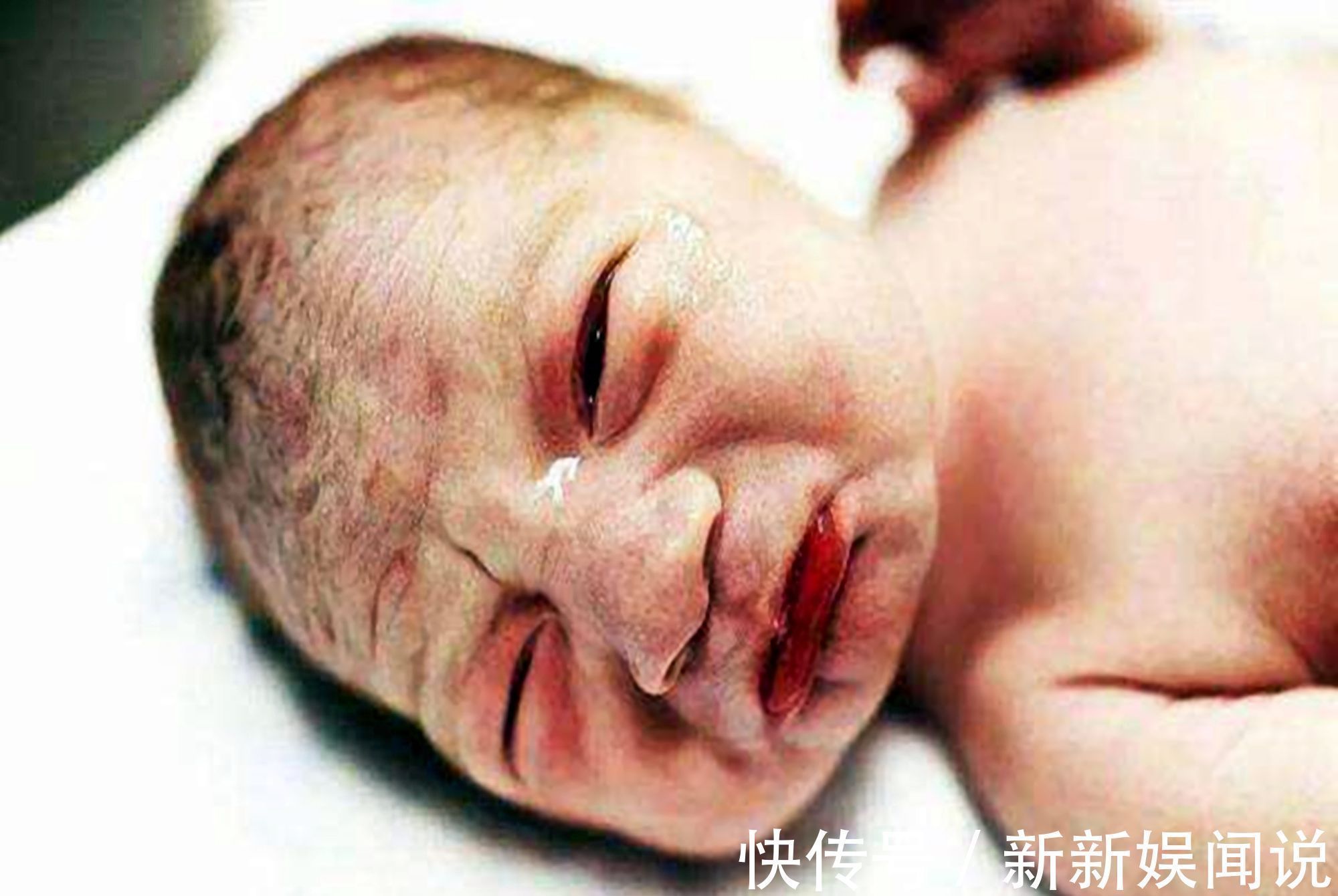 维娘胎里“整容”是什么体验?医生:孕期注意,你的孩子也不会丑