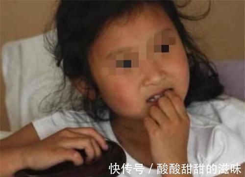 圆圆|5岁女孩喜欢“咬指甲”,宝妈无奈求医,医生太晚了,拔了吧