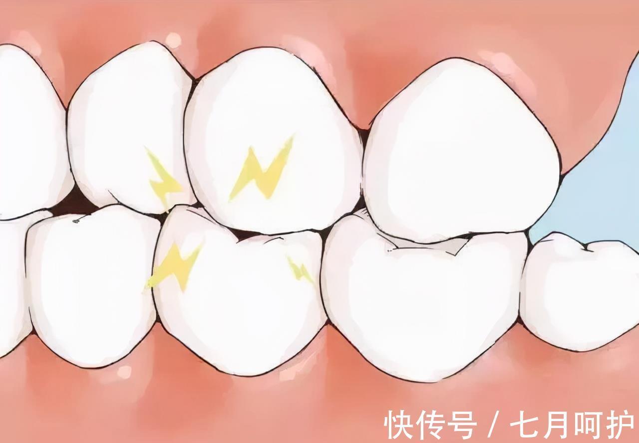 宝宝|宝宝夜间“咯吱”磨牙,六招帮孩子铲除这个坏习惯,家长必看