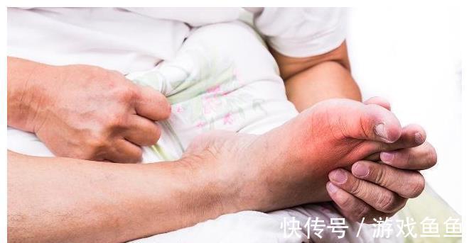 多喝水|尿酸高的人,饮食注意3多2少,或能帮助控制尿酸,远离痛风