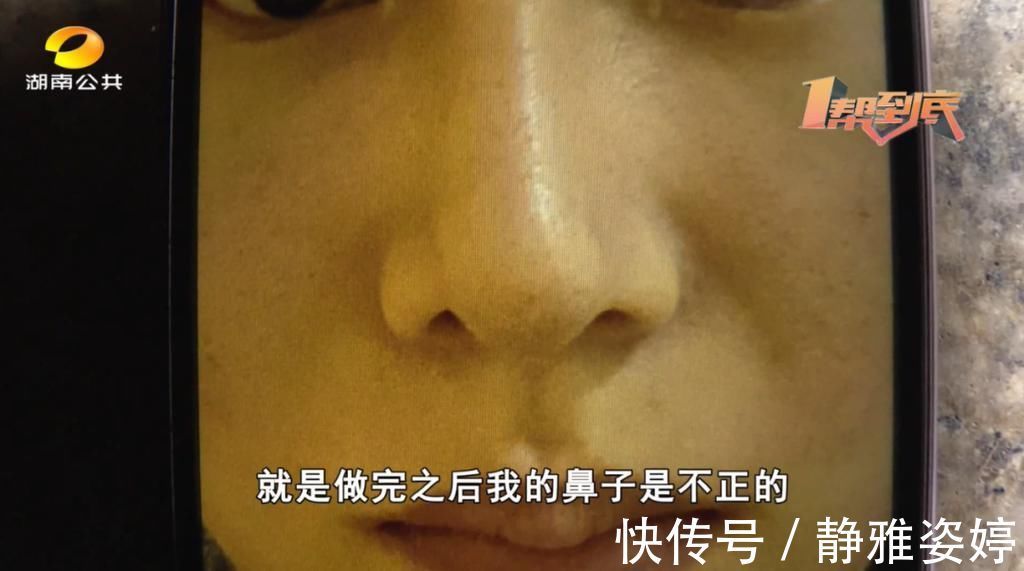医美 我的鼻子整歪了,乔雅医美:拍视频让你“火”!