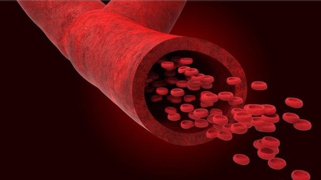 胆固醇|不想血管一年比一年堵,教你4个方法,靠饮食疏通血管