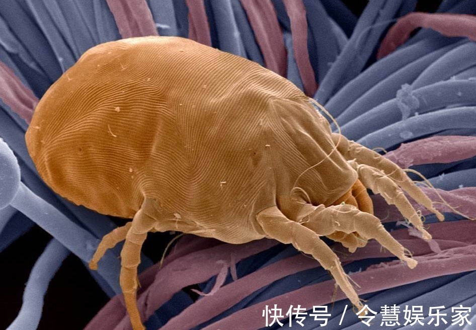 洗床单时,加一点“它”,可以把螨虫杀死,比晒太阳还管用