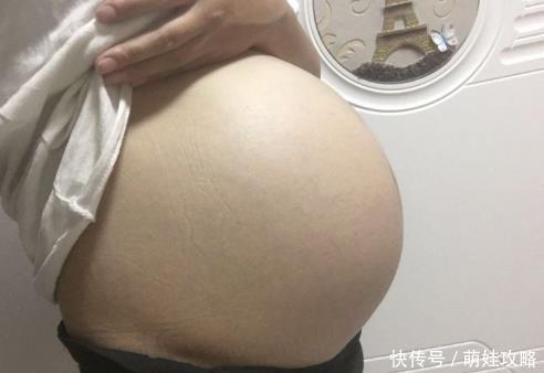 妈妈们|脐带绕颈一周,可能有这些影响,准妈妈要多留心眼