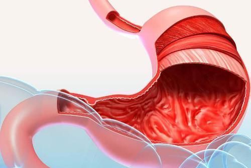 了, 每天坚持吃, 修复胃粘膜, 远离老胃病