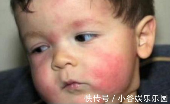 果汁|一碗粥竟差点要了8个月孩子的命,儿科医生:宝宝进食需要谨慎!