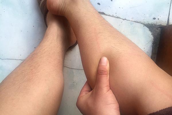 恶性肿瘤|体内有恶性肿瘤的人,身体一般会有5个表现,若中招,尽量查查