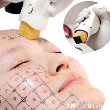 医疗美容 热玛吉一次能维持多久?本文解析热玛吉的维持时间及注意事项!