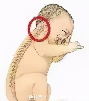 婴儿|“长颈鹿”宝宝火了,从小拥有天鹅颈,网友:赢在起跑线