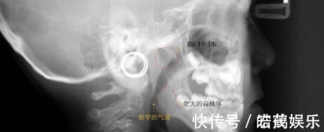 老公|3岁女儿越长越像猴子,老公怀疑老婆以前整容,查出原因家人凌乱!