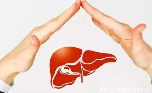 蜘蛛痣|肝变“硬”和吃面条有关?医生坦言:养肝护脏,这2种食物要远离