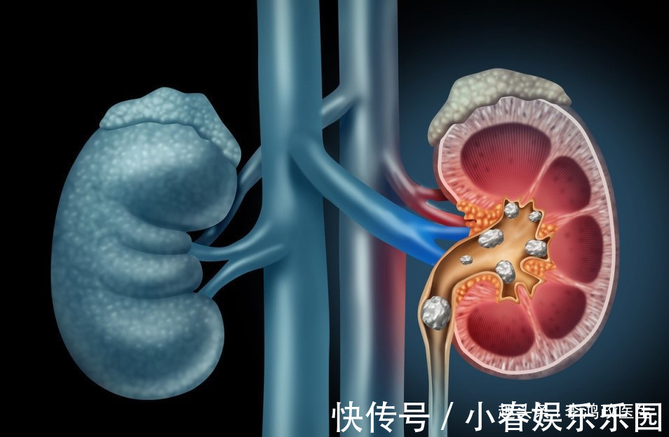 医生|52岁男腹痛,医生怀疑阑尾炎,剖开了他肚子后蒙了,不是阑尾炎