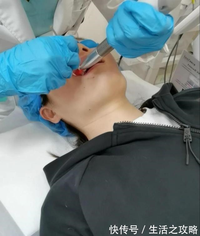 热玛吉 不吹不黑不P图,卡戴珊同款医美真实效果如何!