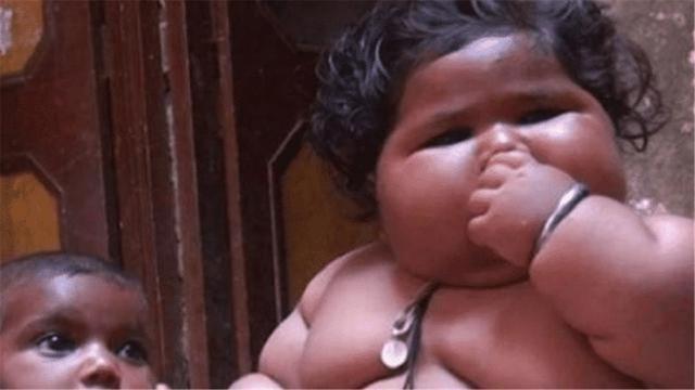 孩子|那个1岁体重高达45斤的孩子,太能吃父母担心养不起,如今怎样了