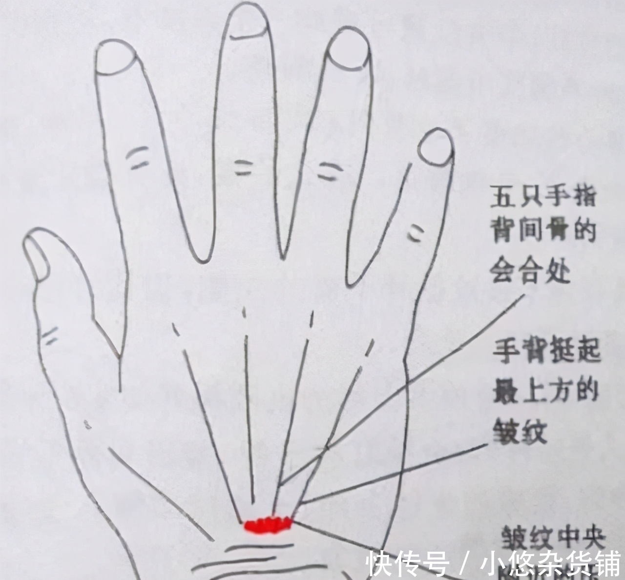 胰岛素|血糖高的人,身体有4个表现,若一个都没有,血糖还算稳定