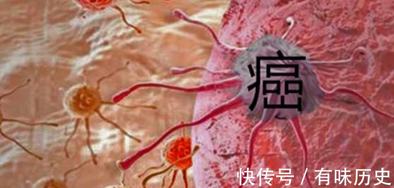 三防线|守住三条线癌症无法上身，那么抗癌三防线是哪三条线？