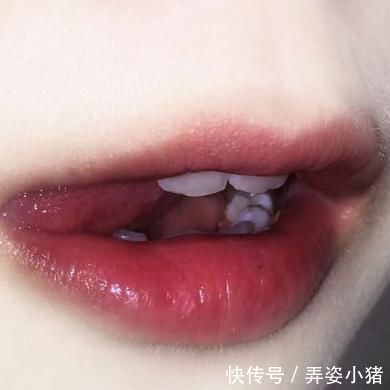 过敏|青春期女生想变“薄嘴唇”,这3恶习趁早改,否则早晚变“火锅唇”