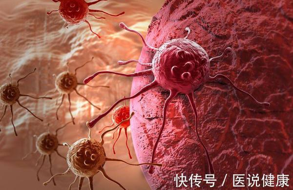 肝功能|肝不好，脸先知！医生：脸上若有这3个特征，或是肝脏癌变的信号