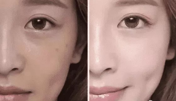 肌底|原来这才是正确护肤顺序，别再先涂爽肤水，不然皮肤暗沉，毛孔大