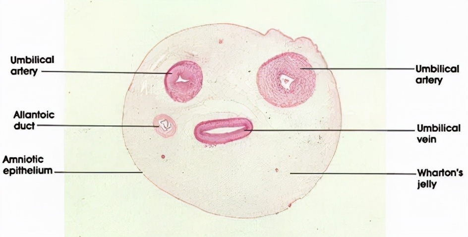 上文中|肚脐眼里连的根本不是肠子!为什么不能乱抠肚脐眼?终于搞明白了