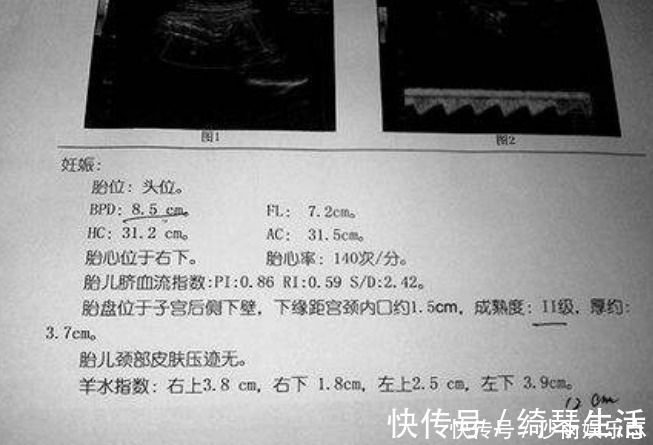 宝宝|孕期，孕妈做四维彩超若有这些信号，怀男孩的可能性大吗