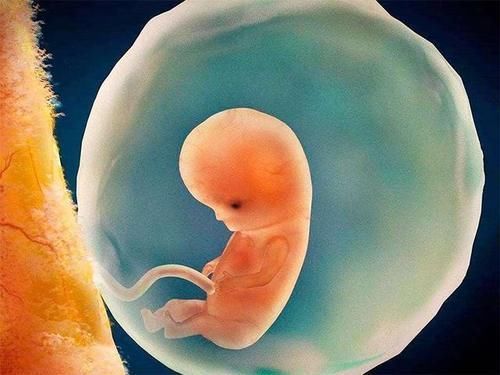 孕囊|怀孕两个月,检查没有胎心胎芽,只有个空囊?这是什么情况啊?