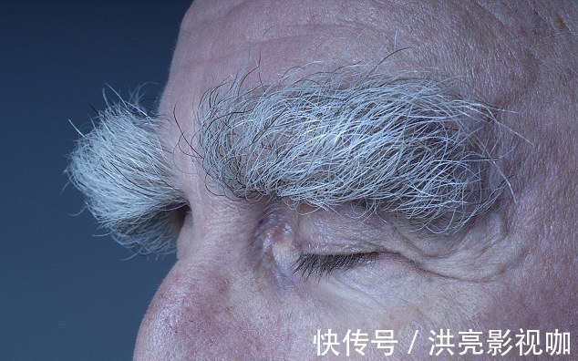 长寿|男女一样,此处“毛”越多可能越长寿,很多人却嫌丑