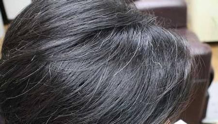 白发|女人不到50岁就满头白发,多半与3点有关