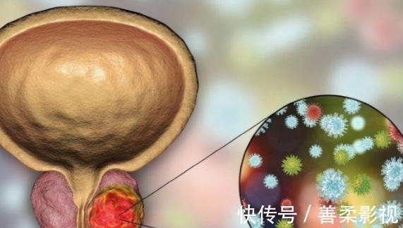 尿黄如茶|前列腺炎的“克星”不是车前草,而是它, 你若爱吃,前列腺或更强壮