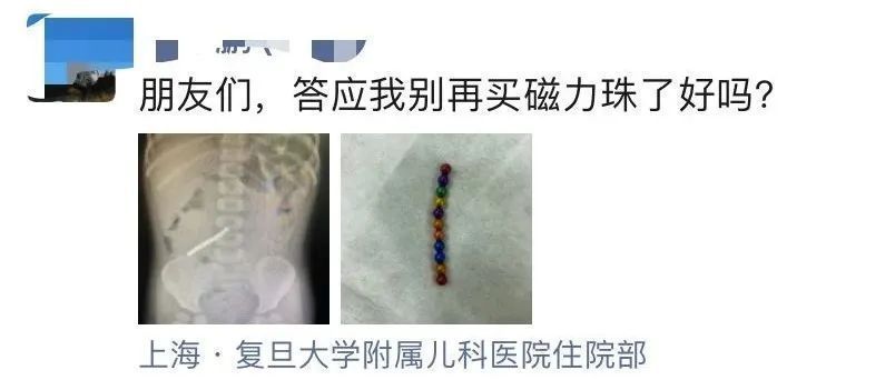 又是磁力珠！青岛一4岁娃不慎吞下36颗，已在体内穿成项链……