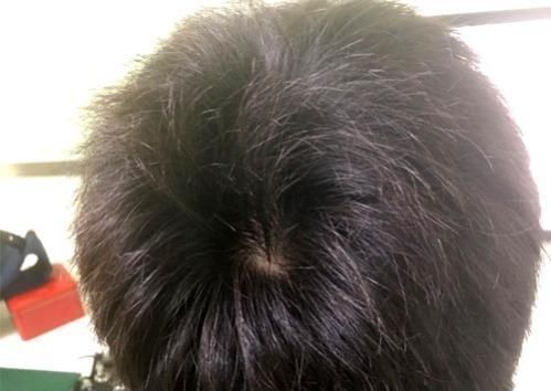 硬朗|男人悄悄衰老的5大“迹象”，只要没超过3个，就说明你还比较硬朗