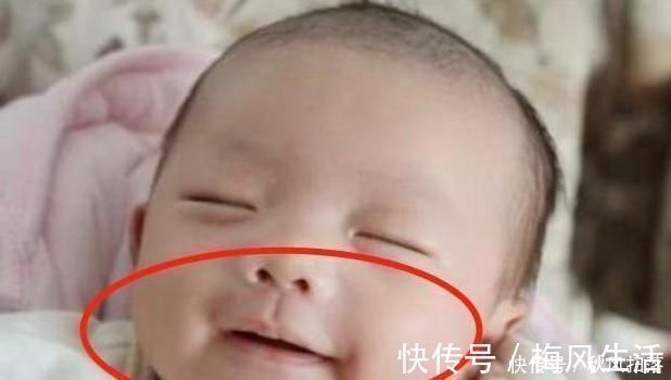 宝妈|2岁孙子总咧嘴笑,奶奶发现不对劲急忙送医,医生幸好发现及时