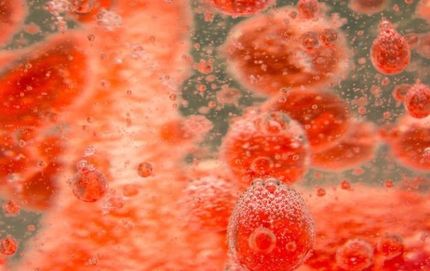 高血脂患者|身体出现4种表现,建议赶紧去查血脂,早发现早治疗