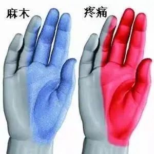 当心|手麻、手痛，熟睡中被“麻醒”？西安医生提醒：上班族当心