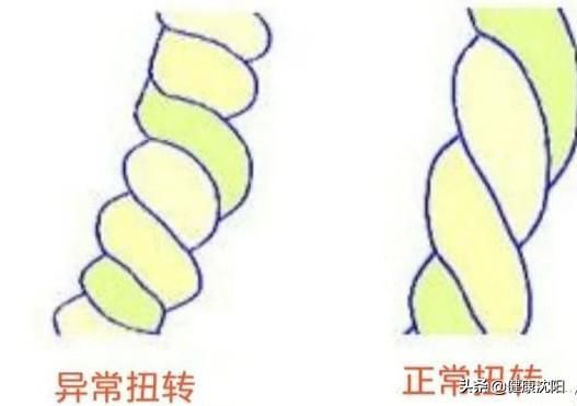 说说脐带扭转|健康科普堂 | 胎动