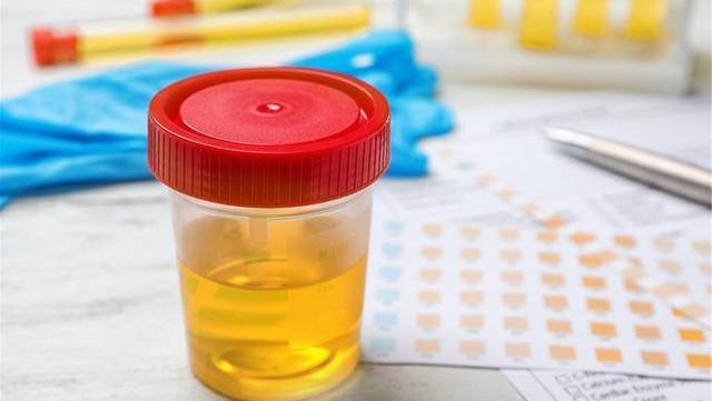 衰老期|男性衰老标志一般有“1小2大3臭”,假如没有,说明你还年轻