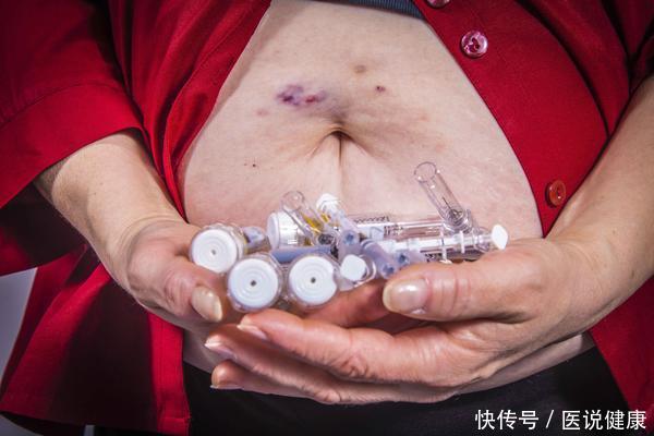 患者|糖尿病来临前,往往有这3种信号,若你全占,需重视