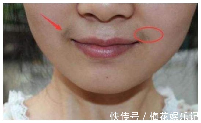 子宫|女性有没有妇科病,看脸就知道!希望你没有这4个表现!