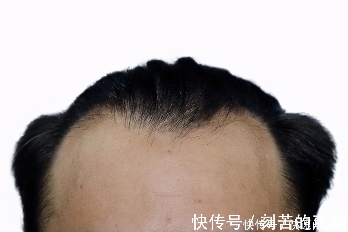 牙齿|男人第一个衰老信号通常在腹部,出现肚子变大、便秘,要重视起来