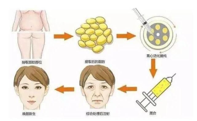 面部凹陷太显老，想要变回少女脸，你得这样做！