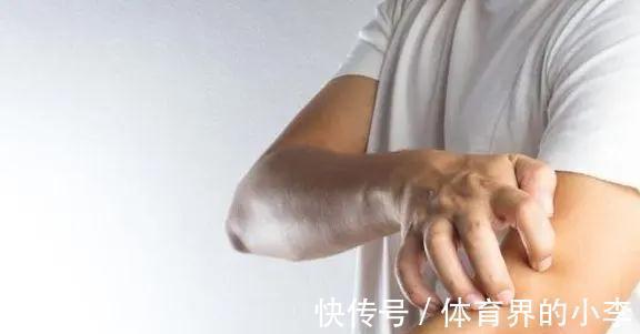 刘哥|身体2处“发痒”，别误以为是过敏，或是肝脏癌变发出的求救信号