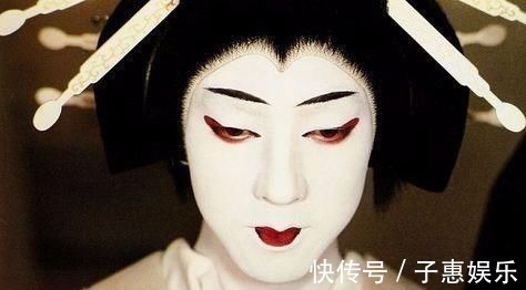 发育不良|宝宝长得太漂亮也是一种病?“歌舞伎综合征”到底是个什么鬼