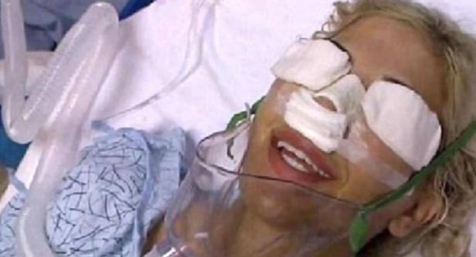 隆鼻 女子花重金整容,一年经历13次整容手术,整容前后判若两人