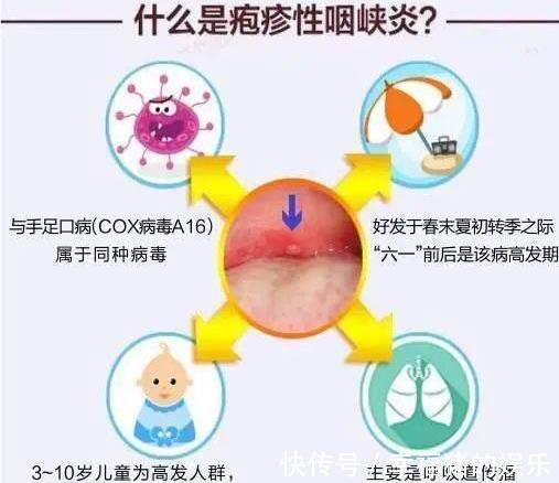 夏季|夏季：“疱疹性咽峡炎”进入高发期，一不小心宝宝就“中招”！