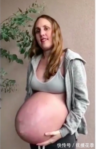 检查|女子怀孕早期肚子变尖发紫，医生检查完后，全家喜笑颜开
