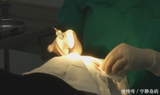 微整|女子去美容院做双眼皮,医生竟将手术针“落”在眼睛里