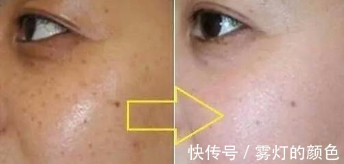 药店|药店有一种乳膏, 皮肤越擦越白, 全是胶原蛋白, 可惜知道的人稀少!