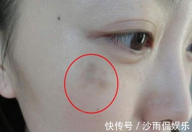 内分泌失调|女性有妇科炎症,脸上或许有4种表现,你若都不占,子宫很健康